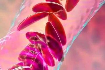 Paravalvular