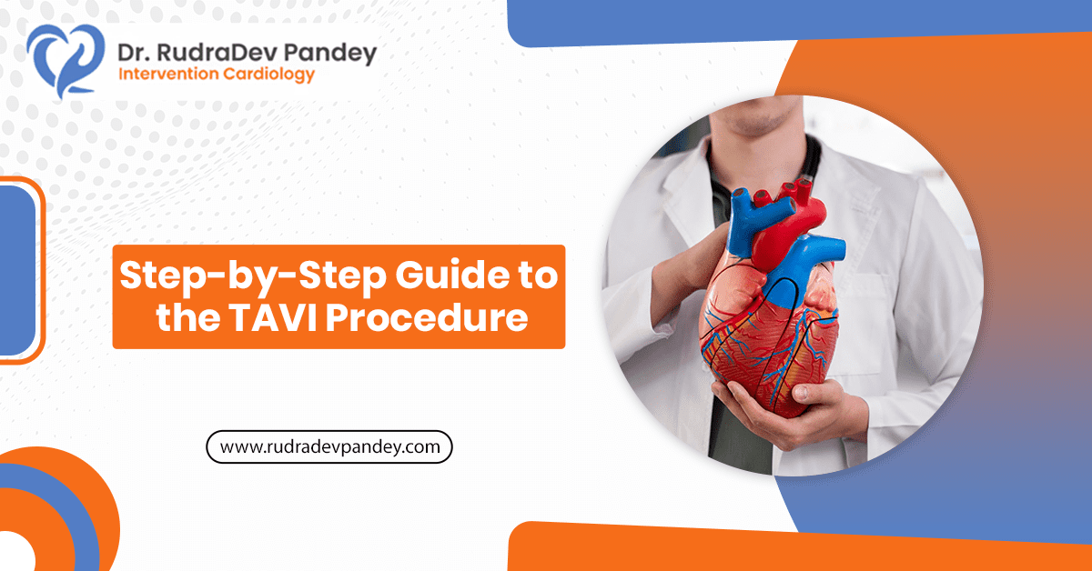 Step-by-Step Guide to the TAVI Procedure