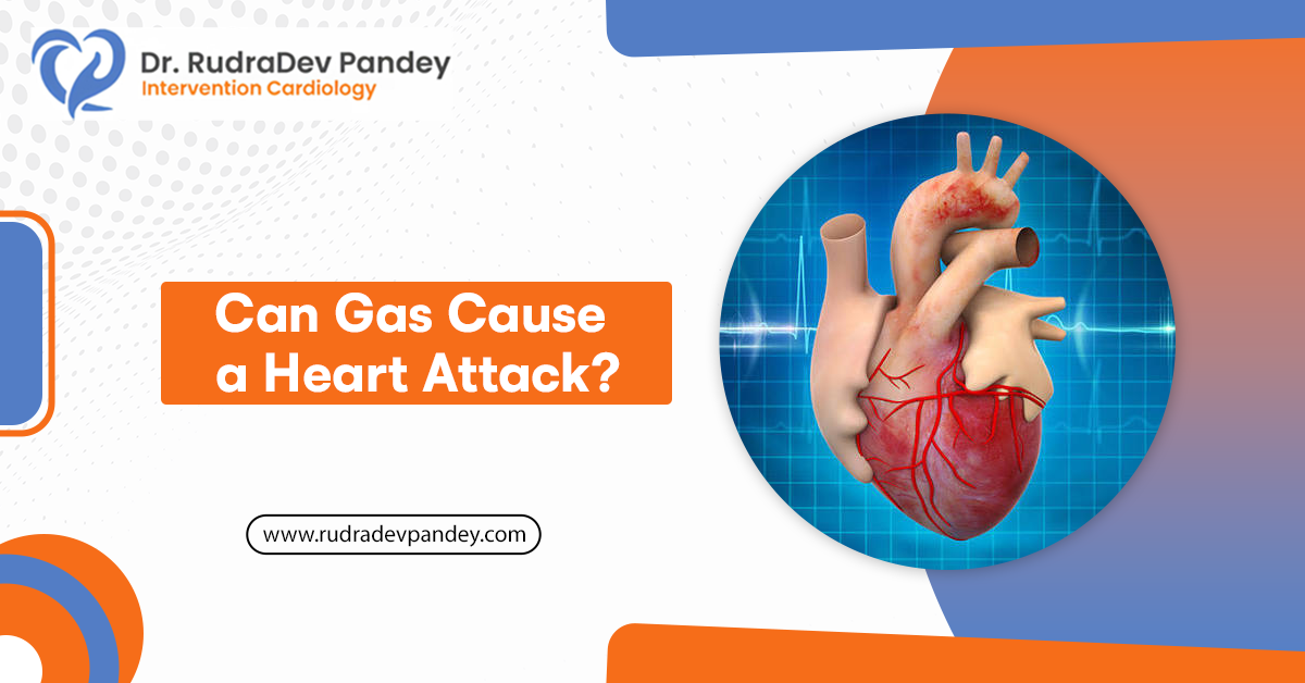 Can Gas Cause a Heart Attack?