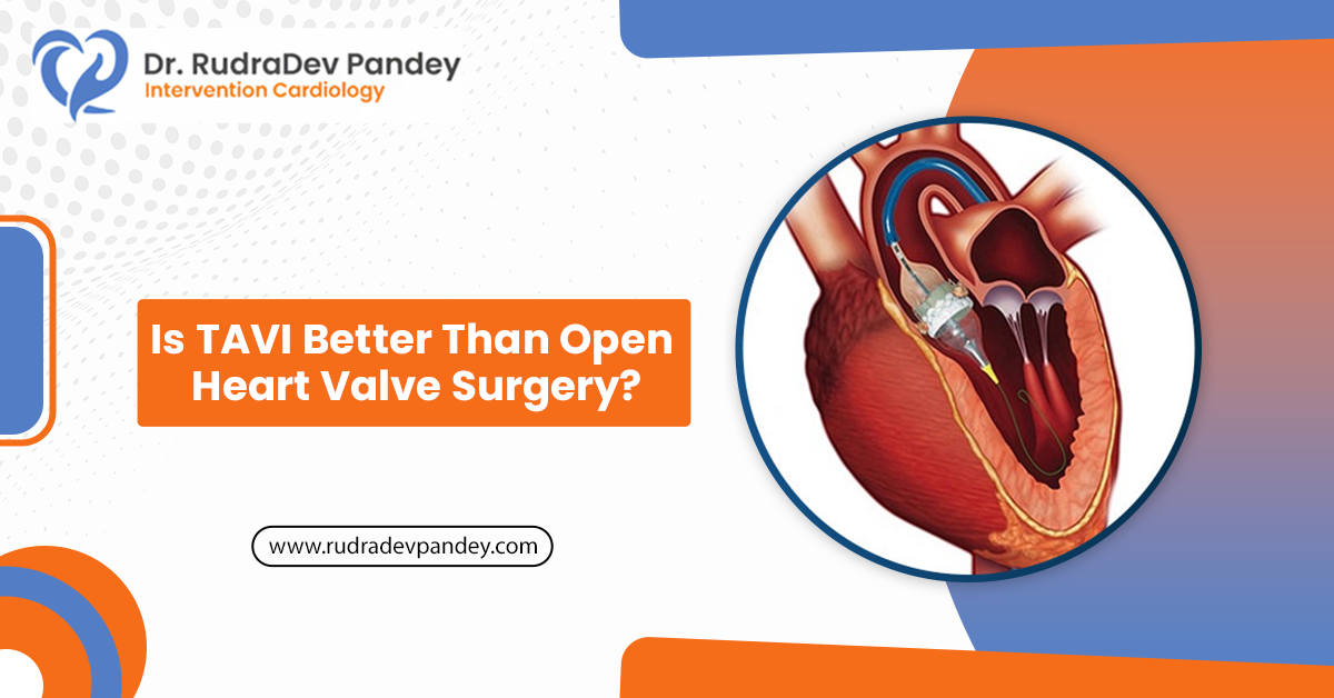 Is TAVI Better Than Open Heart Valve Surgery?