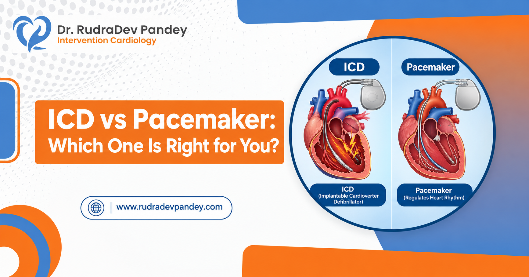 ICD vs Pacemaker: Which One Is Right for You?